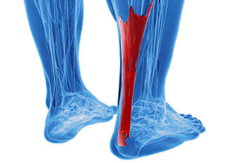 Achilles Tendon Specialist Achilles tendon treatment in the Ventura County, CA: Thousand Oaks (Simi Valley, Camarillo, Moorpark, Oak Park) and Los Angeles County, CA: Calabasas, Cornell, Agoura Hills areas